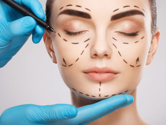 Concept de chirurgie plastique