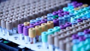 Un fournisseur de tests de laboratoire américain a divulgué les données de santé de 1,6 million de personnes