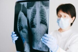 Les centres romands d’imagerie médicale 3R victimes d’une cyberattaque